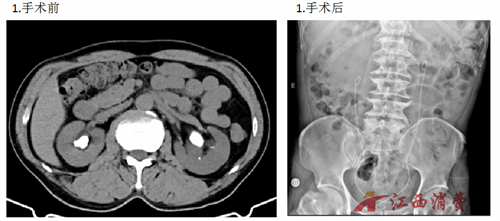 1770173399887884.png 640 (1).png