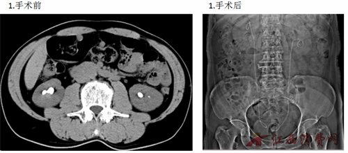 1770173409841315.png 640.png